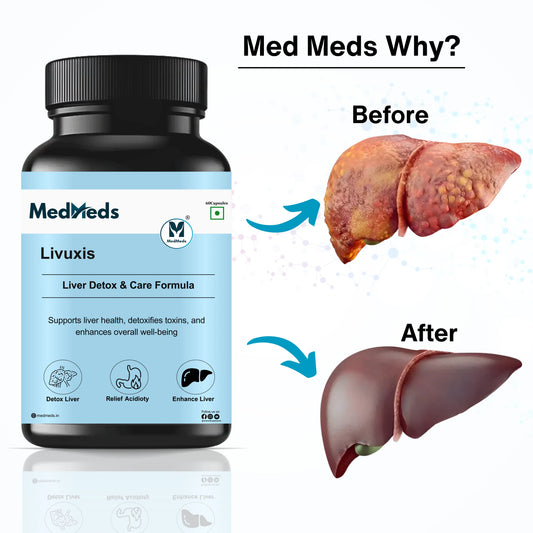 Livuxis – Natural Liver Care Formula My Store