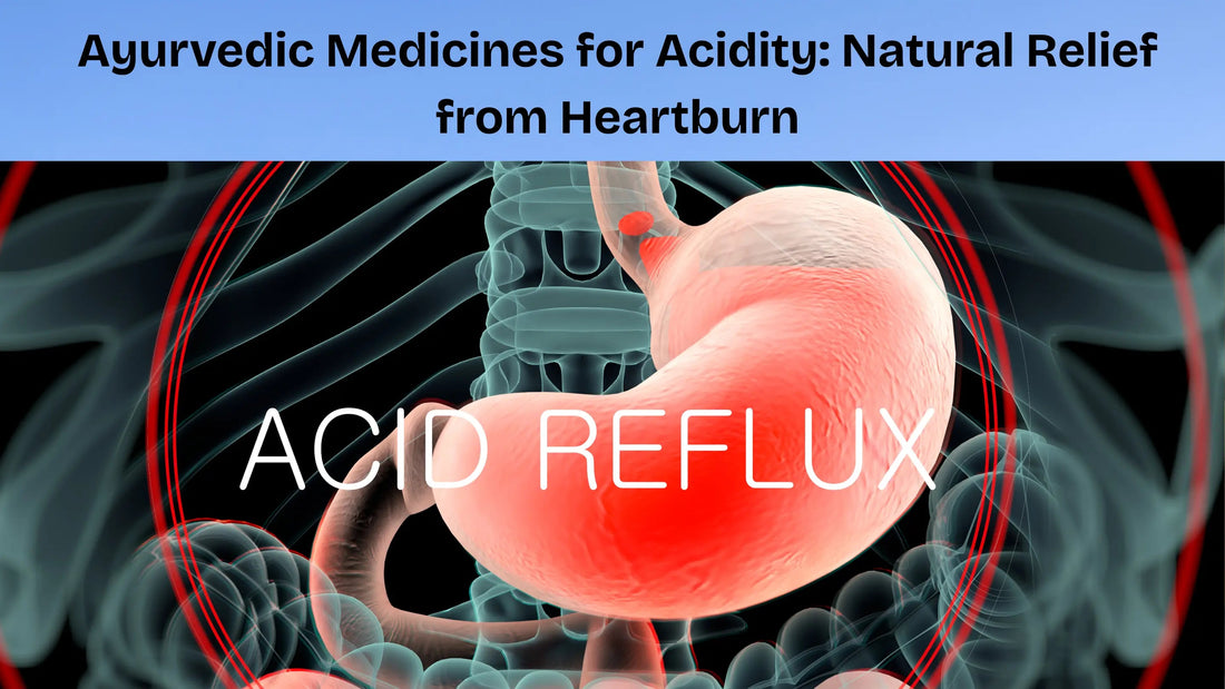 Ayurvedic-Medicines-for-Acidity-Natural-Relief-from-Heartburn My Store