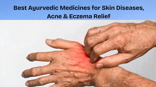 Best Ayurvedic Medicines for Skin Diseases, Acne & Eczema Relief - MedMeds