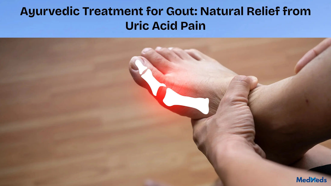 Ayurvedic Treatment for Gout