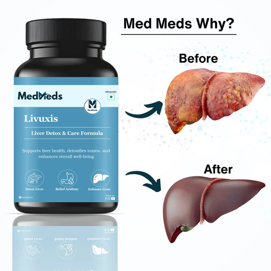 Livuxis – Natural Liver Care Formula - My Store
