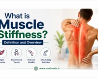 what is muscle stiffness